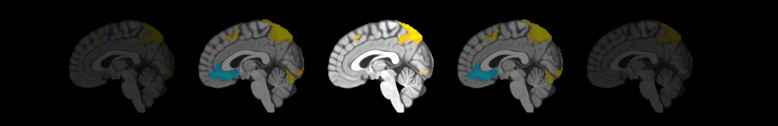 A Ciência Por Trás do Lumosity