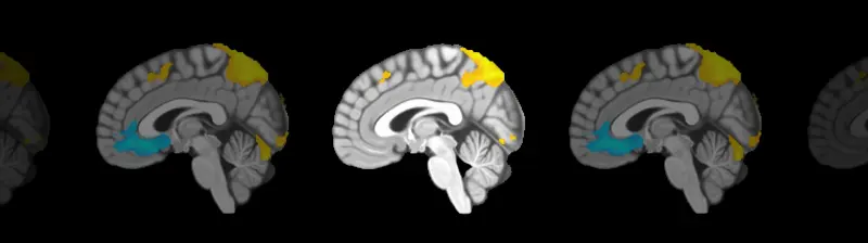 A Ciência Por Trás do Lumosity